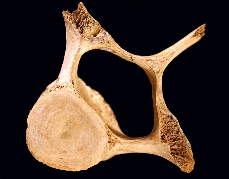 Colour image of a brown bone